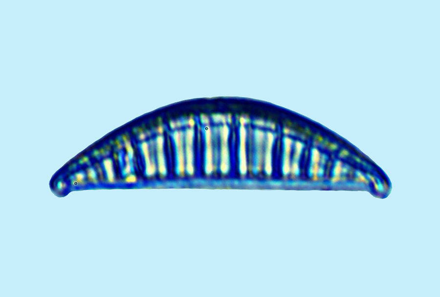 Rhopalodia gibberula