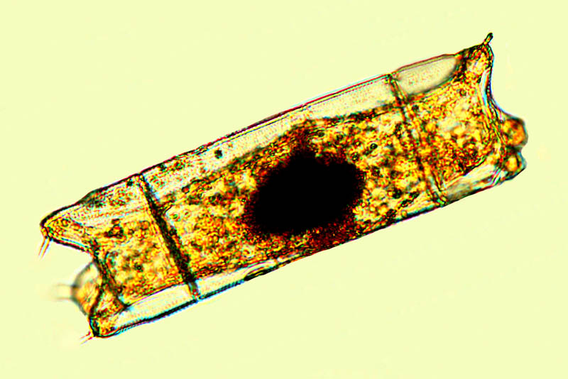 Triceratium orbiculatum