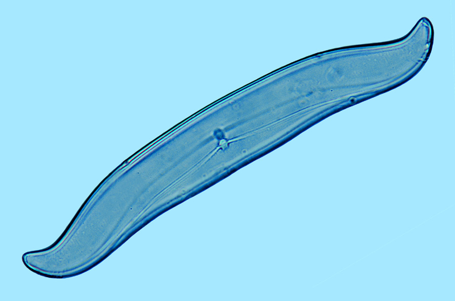 Toxonidea balearica