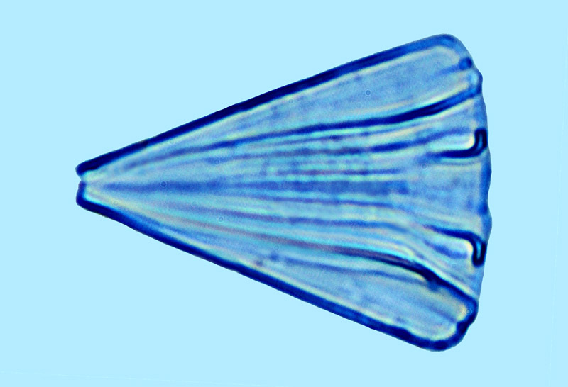 Licmophora oedipus