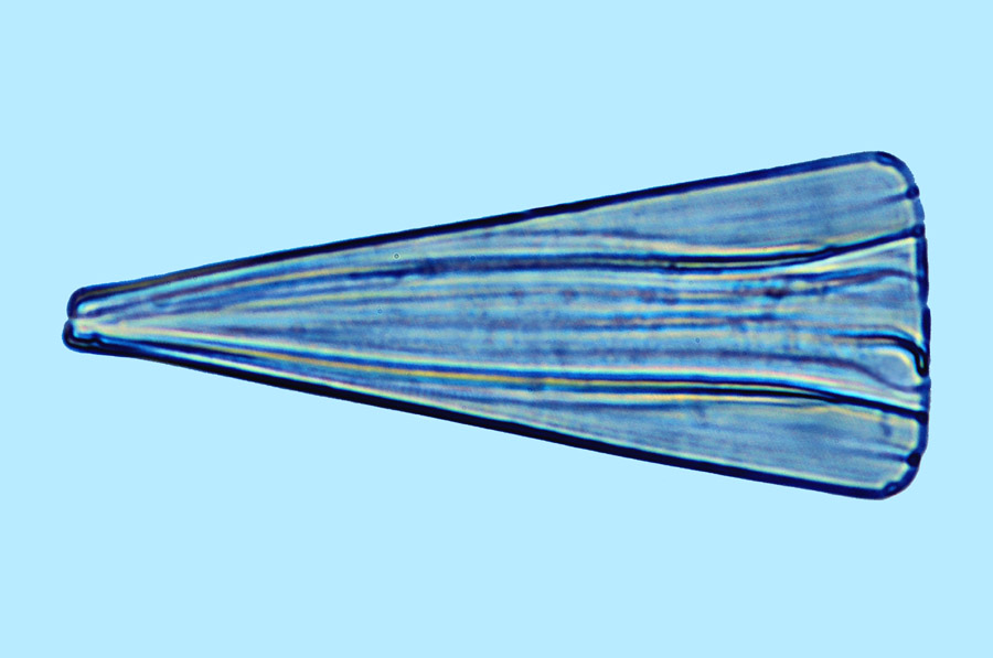 Licmophora paradoxa