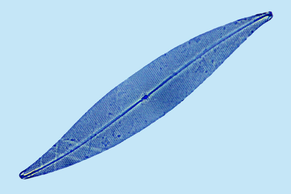 Pinnularia sp