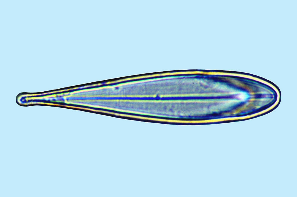 Licmophora nubecula