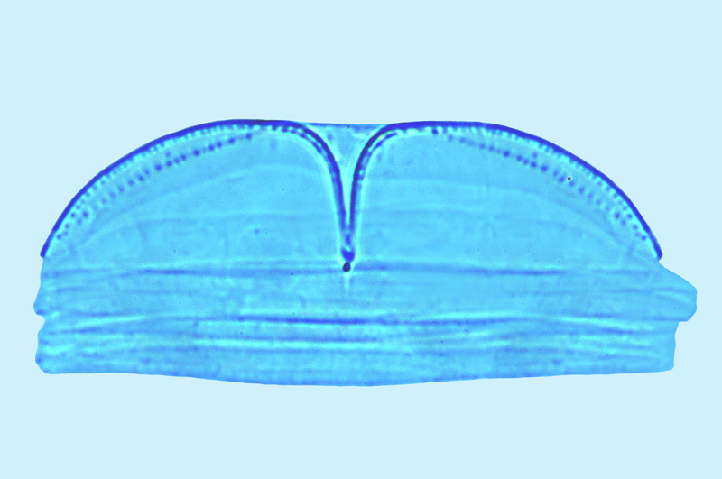 Thalassiophysa hyalina