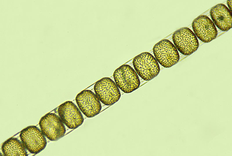 Stephanopyxis palmeriana